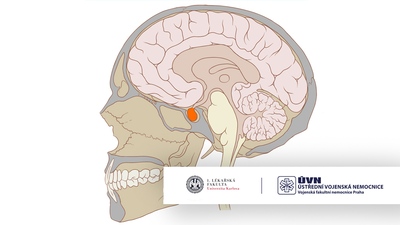 Konzultace pacientů se selární problematikou