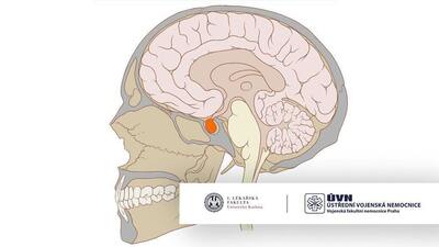 Konzultace pacientů se selární problematikou a využití mezioborové spolupráce
