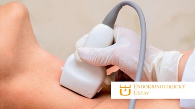 Algoritmus vyšetřování a léčebné metody uzlů štítné žlázy [KAPACITA NAPLNĚNA]